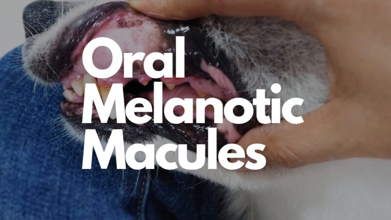 Oral Melanotic Macules